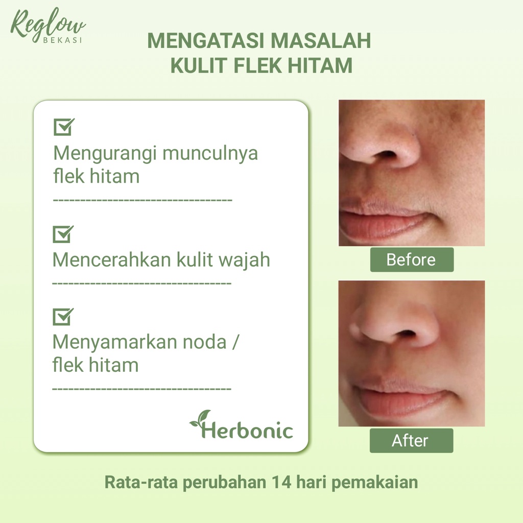 REGLOW Skincare Original BPOM Glowing Skin Treatment Paket Wajah Glowing Perawatan Kecantikan Pemutih Wajah Facial Wash Toner Cream Micellar Water Pembersih Wajah Penghilang Jerawat Flek Hitam Noda Hitam Bruntusan kerutan Inflamasi-5