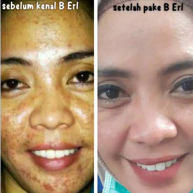 BERL Intense Lightening Day Cream - BERL Day Cream pagi / siang Pencerah Wajah