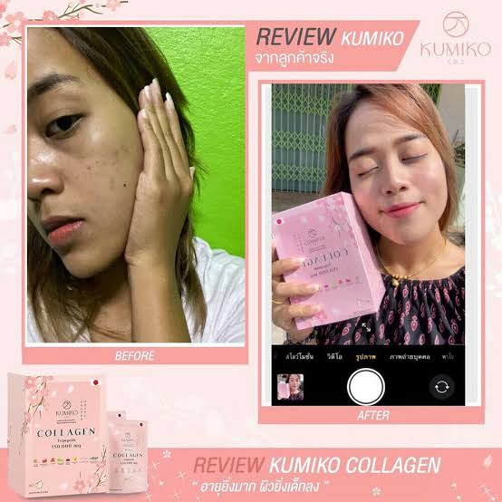 Kumiko Collagen Tripeptide 150.000mg/Minuman collagen/Collagen pemutih kulit/pemutih wajah/pemutih badan/anti jerawat