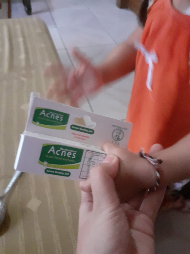 Acnes Sealing Gel 9gr dan 18gr Shopee Indonesia