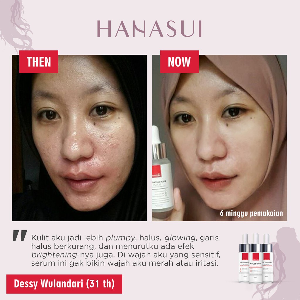 Hanasui Rich Nutrition Serum Hanasui Intense Treatment Serum