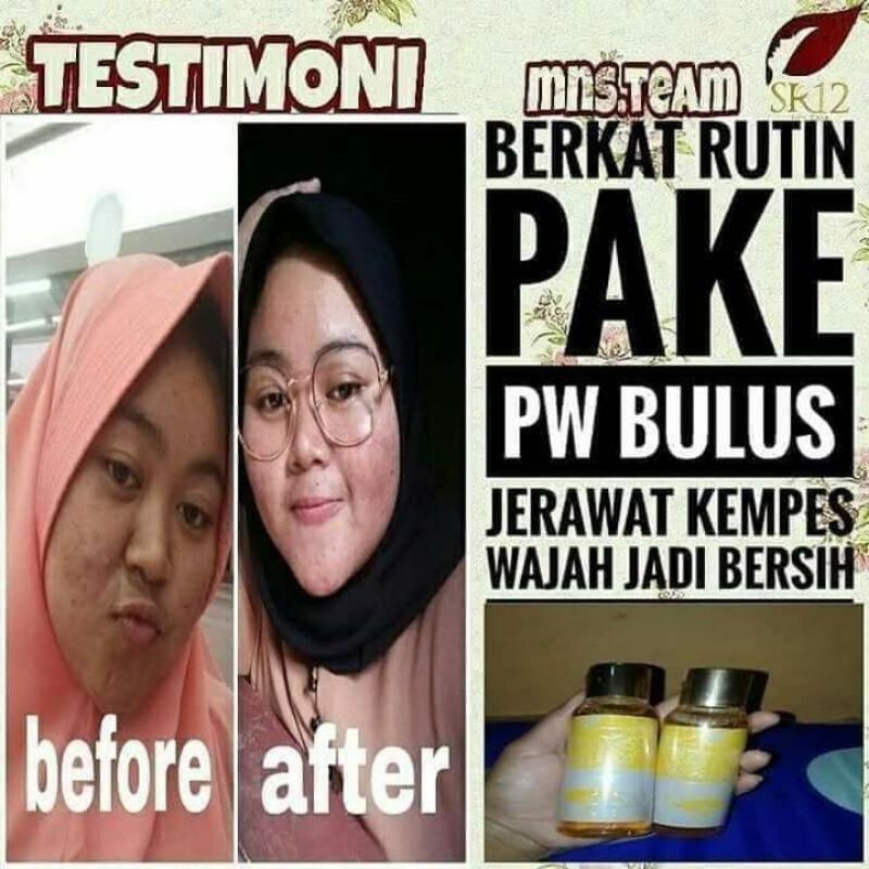 FACIAL WASH BULUS SR12 100ml SABUN CAIR PEMBERSIH WAJAH KULIT NORMAL FLEK HITAM JERAWAT KOMEDO