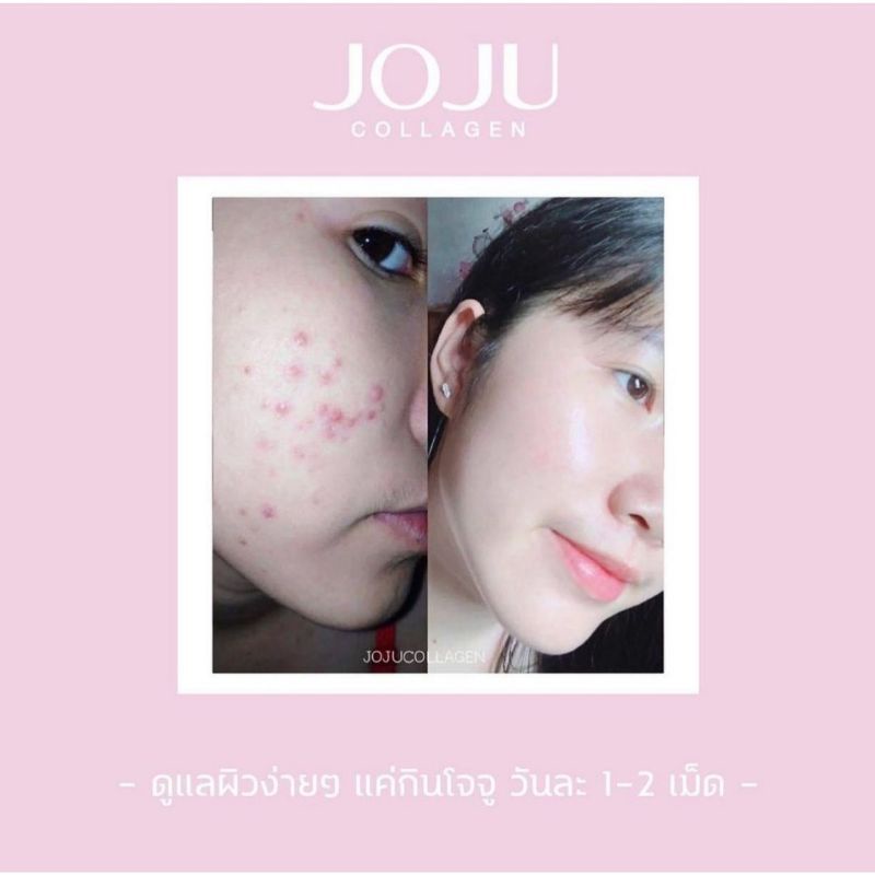 ‼️READY‼️JOJU COLLAGEN ISI 30 KAPSUL (BERSERTIFIKAT)