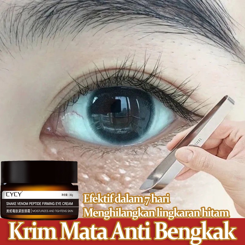 【ORIGINAL】Krim Mata Eye Cream Polypeptide Elastic Repair Eye Cream Krim mata lingkaran hitam 30g Remove Eye Pattern/ Eye Bags /Fat-Free Granules / Fade Dark circles / Moisturizing bpom