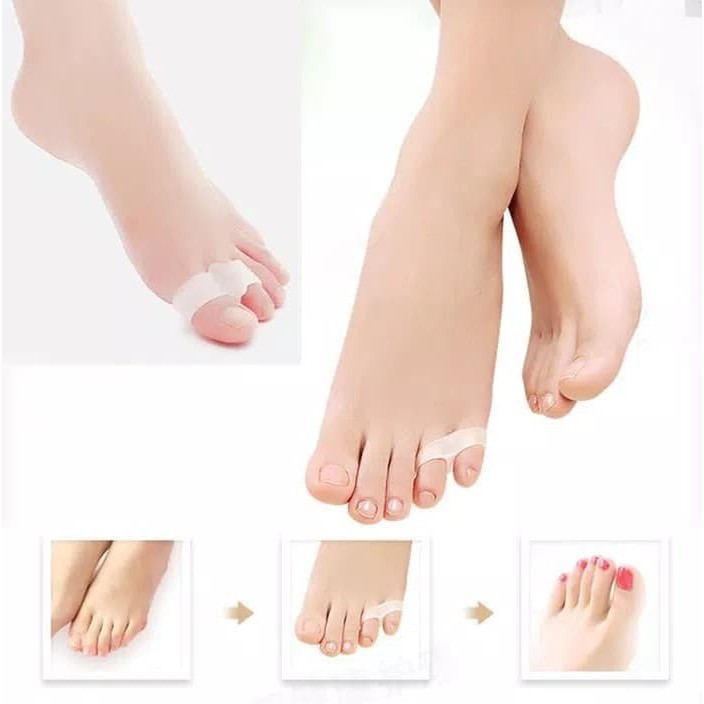 Pemisah jari kelingking gel silicone bunion separator  hallux valgus