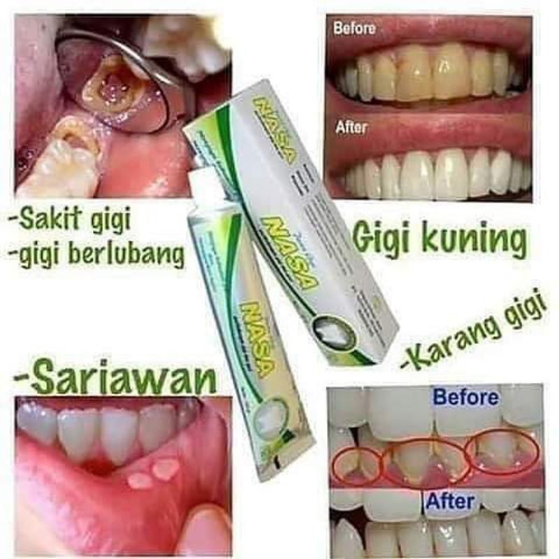 PASTA GIGI / PASTA GIGI NASA / ODOL NASA