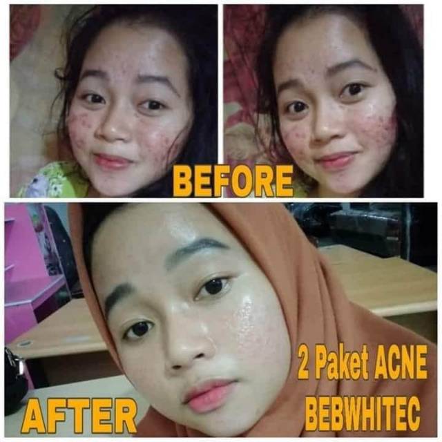 Bbc skincare