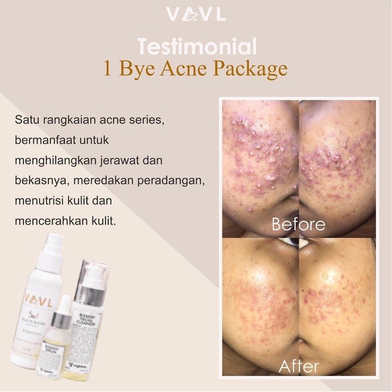 VAVL BEAUTE PACKAGE Skincare Bpom Original