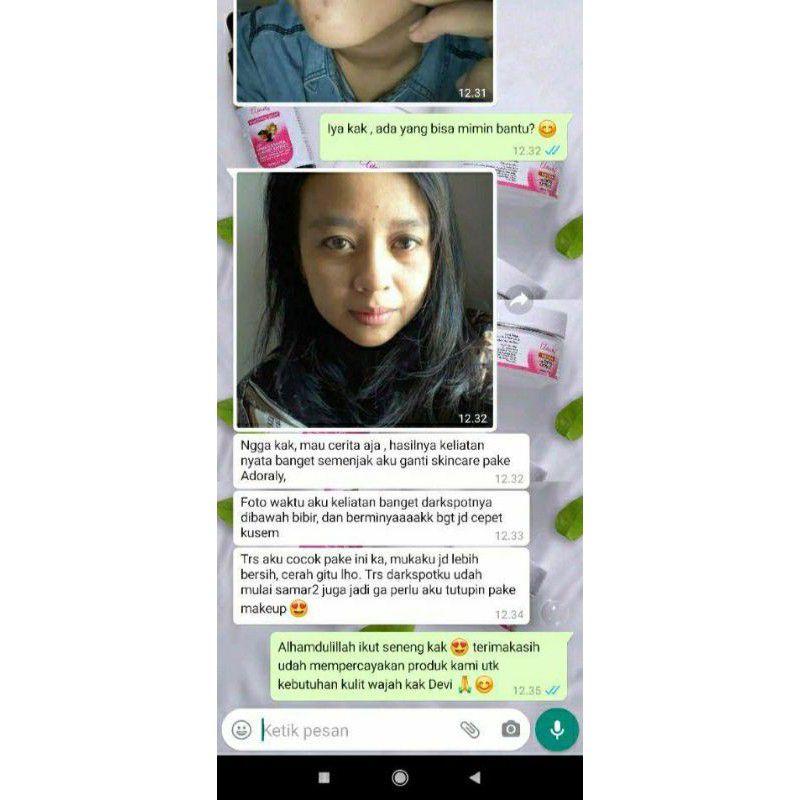 Adoraly Skincare BPOM ORI Aman Busui (1 Paket)[Bonus POUCH+TUMBLER+Masker]-1