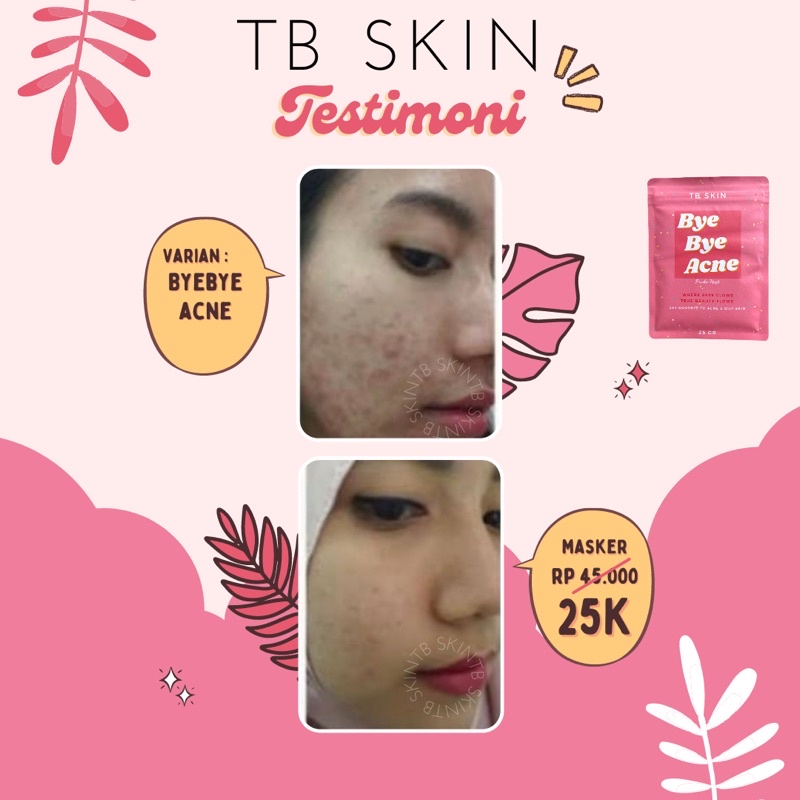 [TB SKIN] Wash Off Mask | Masker Wajah by TB SKIN