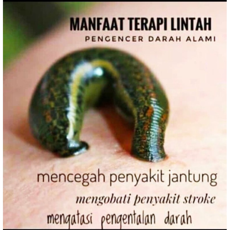 ✓COD✓Lintah Terapi ✓Ukuran L SEDANG