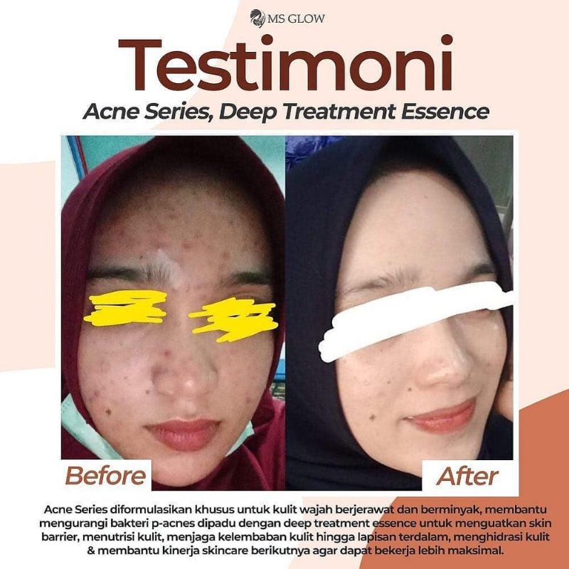 MS GLOW PAKET WAJAH  (WHITENING/LUMINOUS/ULTIMATE/ACNE/WHITE CELL DNA) FREE GIFT-6