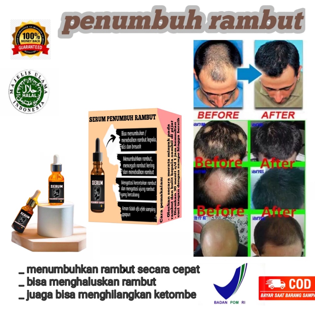 Serum Rambut Penumbuh Rambut / Serum penumbuh rambut secara cepat penumbuh rambut botak / penumbuh r
