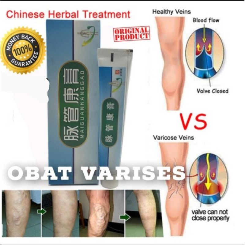 OBAT VARISES SALEP PENGHILANG VARISES