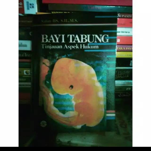 Bayi Tabung  Tinjauan Aspek Hukum