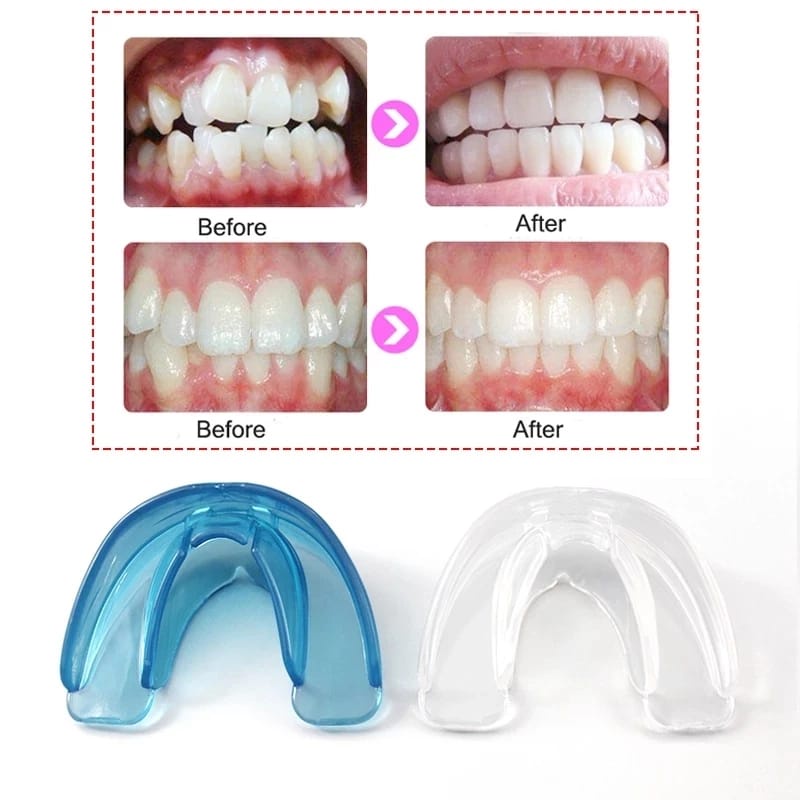 PAKET LENGKAP TAHAP 1 DAN TAHAP 2 Perapih gigi Behel gigi Perapi gigi Perapih gigi original Perata g