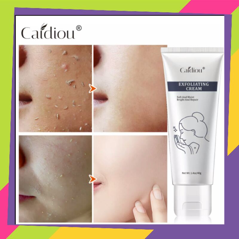 Exfoliating Cream Caidiou Soft And Moist Bright And Repair