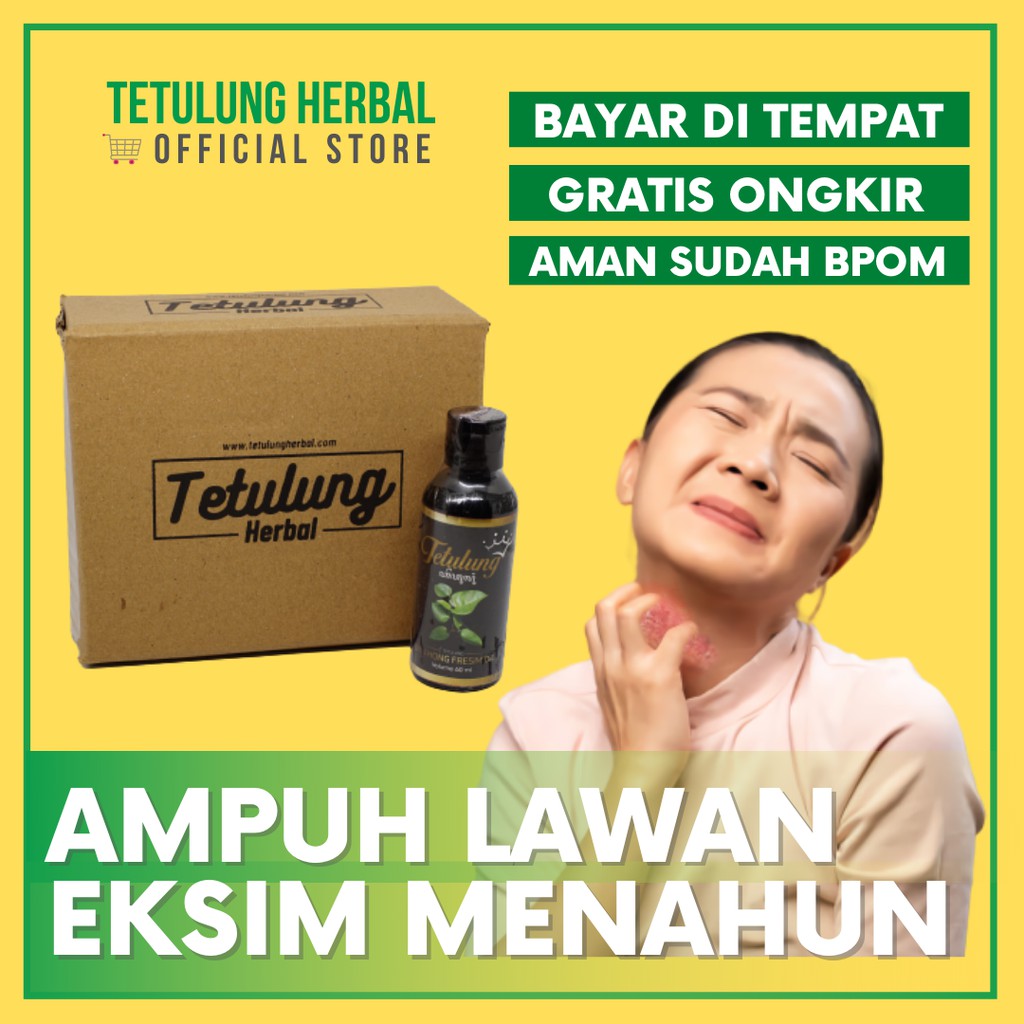 Jual Tetulung Fresim Oil 60ml Obat Minyak Eksim Exim Kering Basah Binahong Menahun Ampuh Indonesia Shopee Indonesia