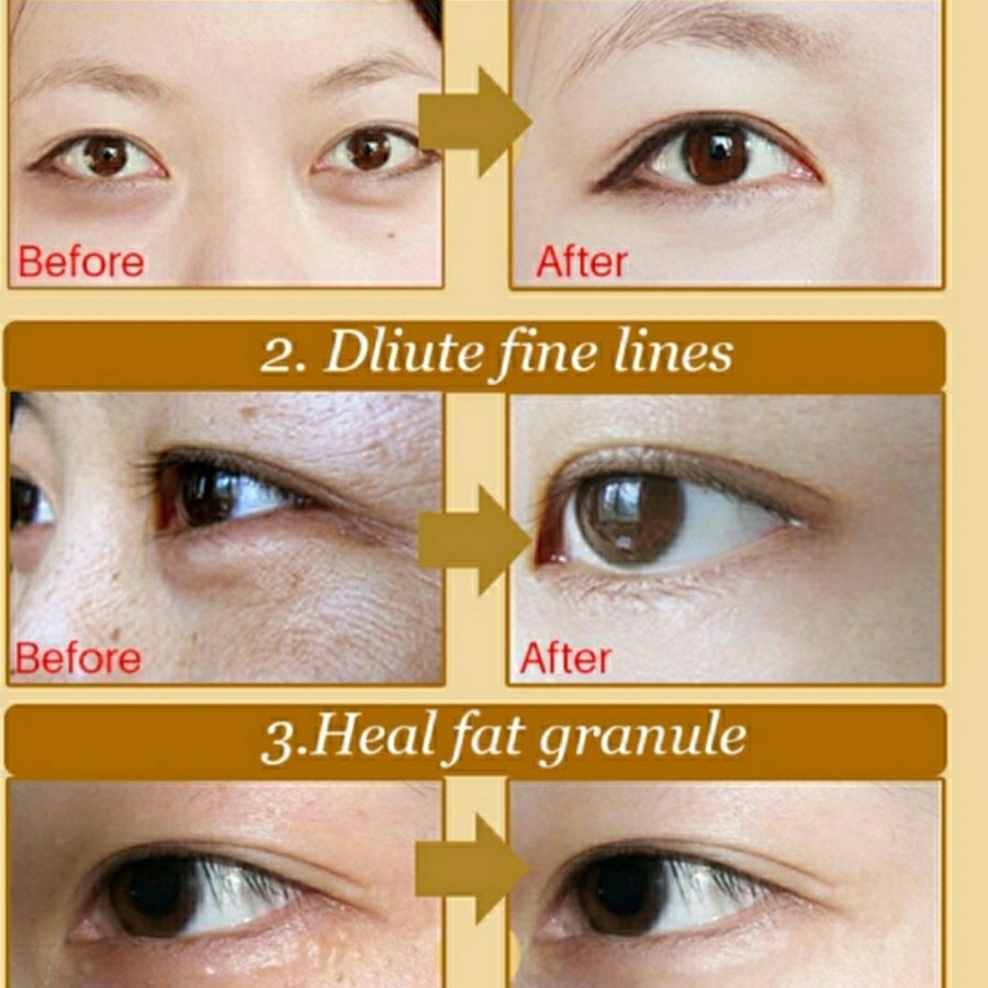 Masker Kantung Mata Panda Anti Keriput Collagen Crystal Gold Eye Bag Mask EyeMask Menghilangkan Kantung Mata Lingkaran Hitam