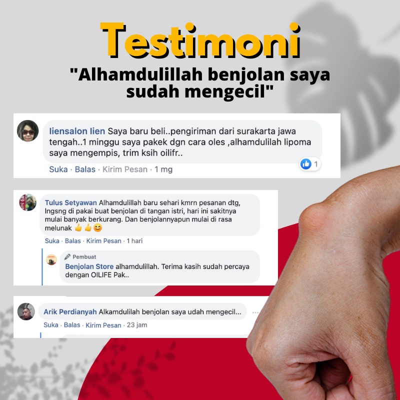 OILIFE Obat Herbal Lipoma / Minyak Oles Lipoma