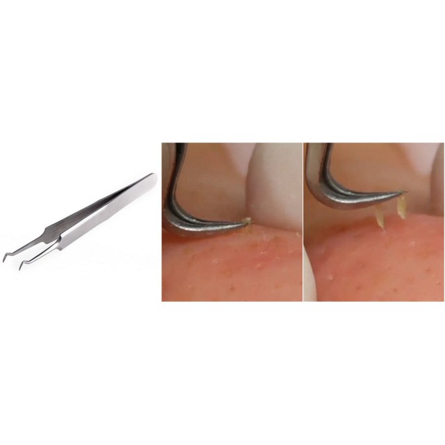 pinset komedo / BLACKHEAD TWEEZER