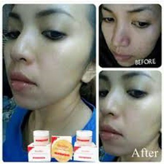 LIYOSKIN KRIM BPOM SKIN CARE LENGKAP DENGAN SABUN COLLAGEN KRIM SIANG DAN KRIM MALAM