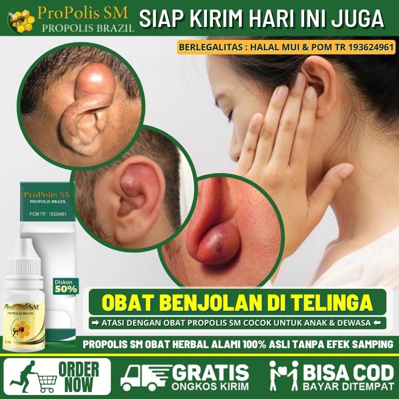 Obat Benjolan di Belakang Telinga Kanan / Kiri, Obat Benjolan Lipoma Benjolan Lemak Benjolan Abnorma