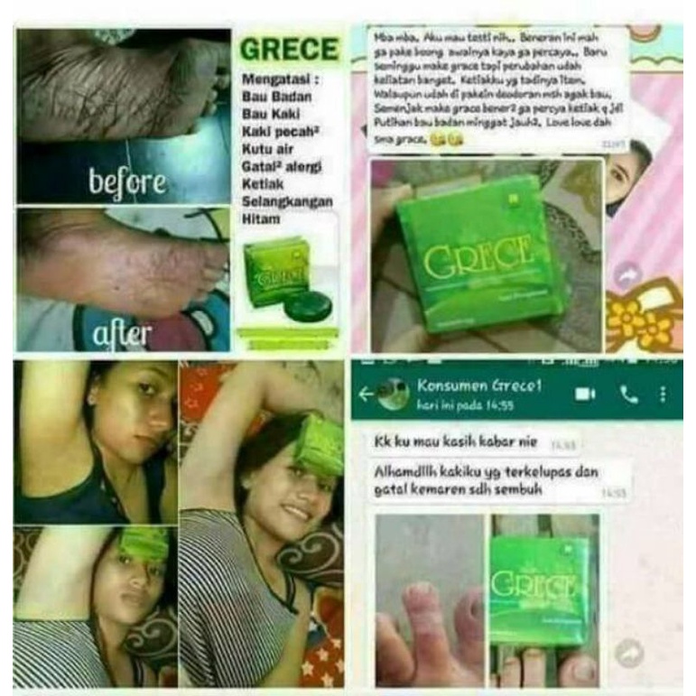 OBAT PANU // MENGHILANGKAN PANU// OBAT PANU MEMBANDEL DI WAJAH // OBAT GATAL OBAT IRITASI AMPUH