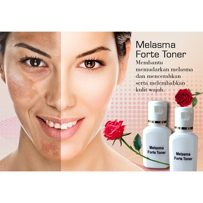 toner for melasma