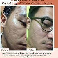 MS GLOW FOR MEN ORIGINAL PAKET WAJAH PRIA LENGKAP | PAKET MS GLOW FOR MEN