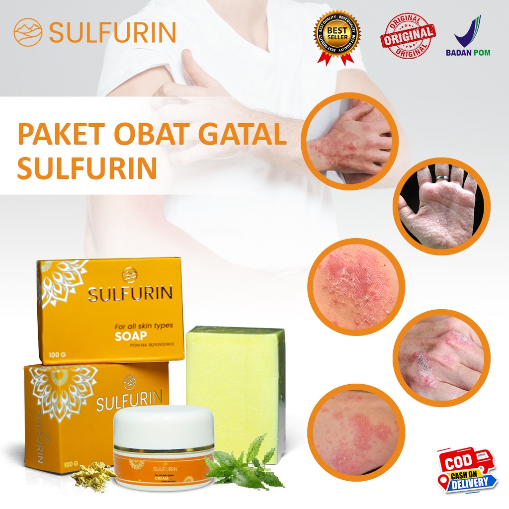 Solusi GATAL Eksim Alergi Biduran Herbal Sulfur Belerang SULFURIN