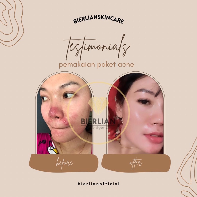 BIERLIAN SKINCARE CREAM WAJAH WHITE GLOW/SUPER WHITE/ACNE/FLEK [Free Pouch+Gift]-3
