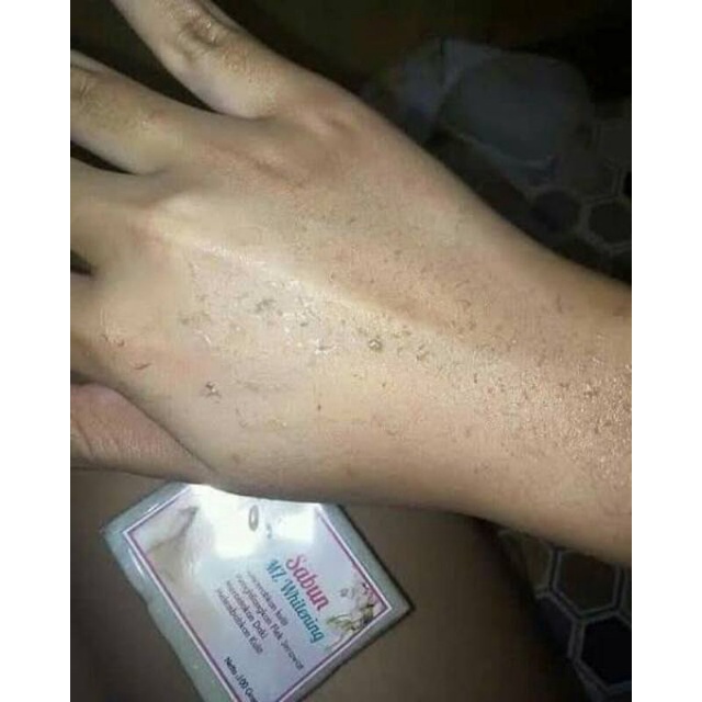 sabun MZ whitening ORI