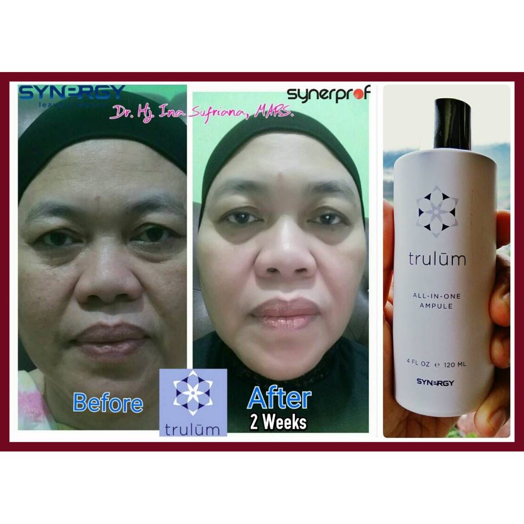 Skincare Herbal Obat Flek Hitam Membandel Trulum Mengencangkan Wajah