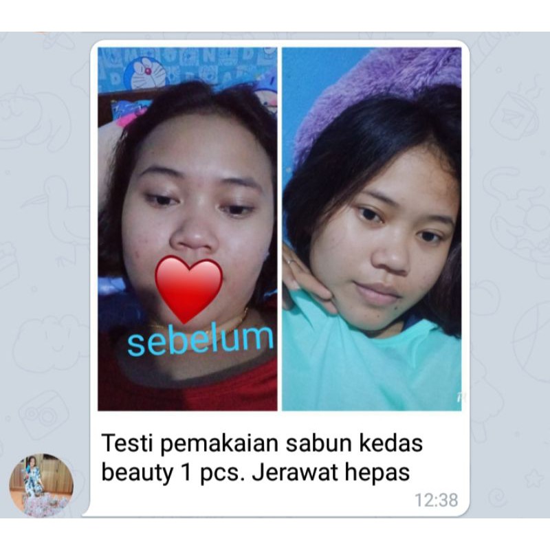 BRIGHTENING SOAP/SABUN KEDAS BEAUTY 100%ORI (COD)-7