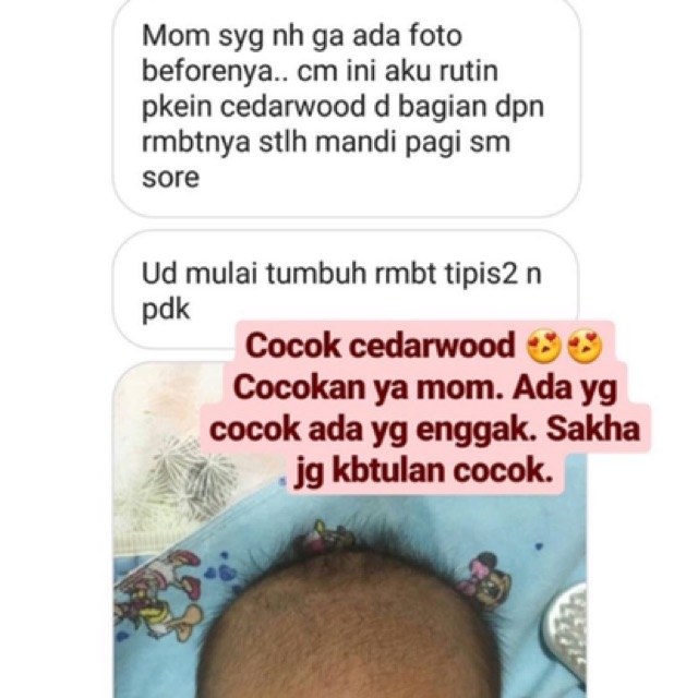 CEDARWOOD Essential Oil + Evoo minyak zaitun. Obat herbal alami anak. Penumbuh pelebat rambut tipis