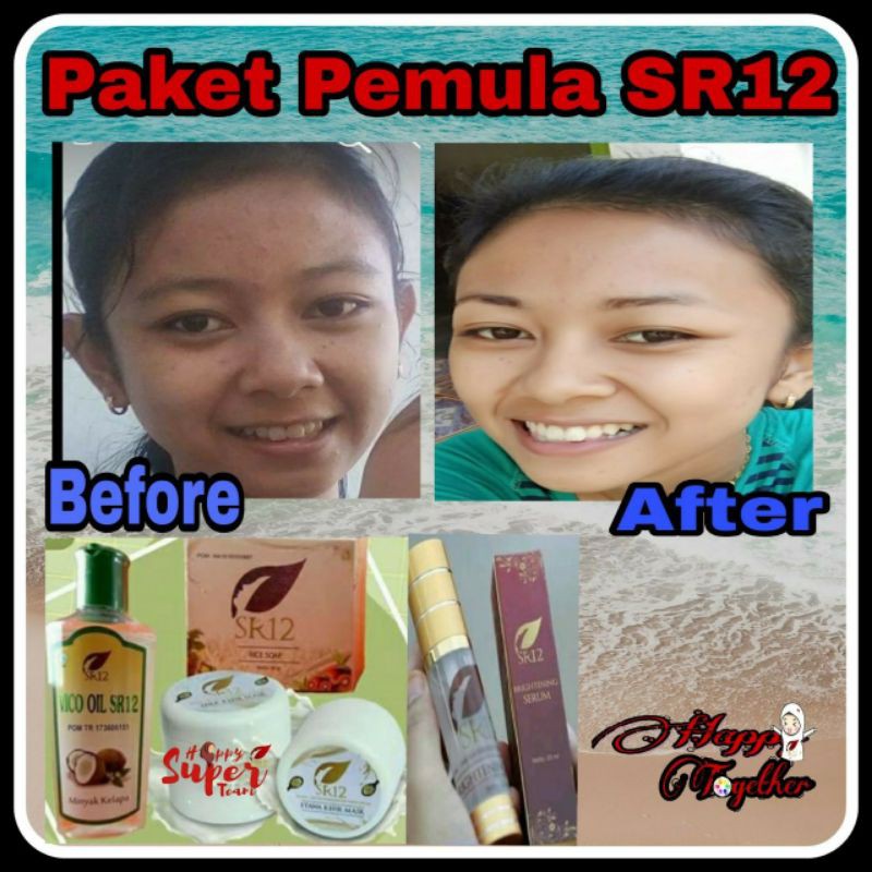 SERUM PEMUTIH WAJAH LIGHTENING SERUM SR12 BPOM / PENCERAH WAJAH GLOWING / ANTIOKSIDAN / saudagarsr12