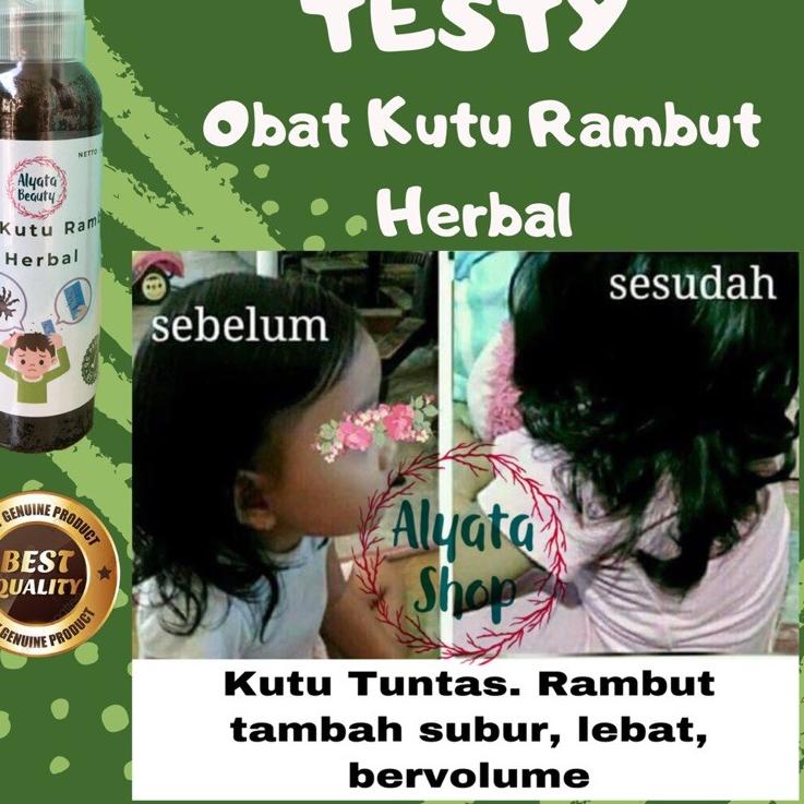 ❤️TERLARIS❤️ Obat Kutu Rambut Herbal Obat Kutu Rambut Anak Dewasa Obat Kutu Rambut Ampuh Perawatan R