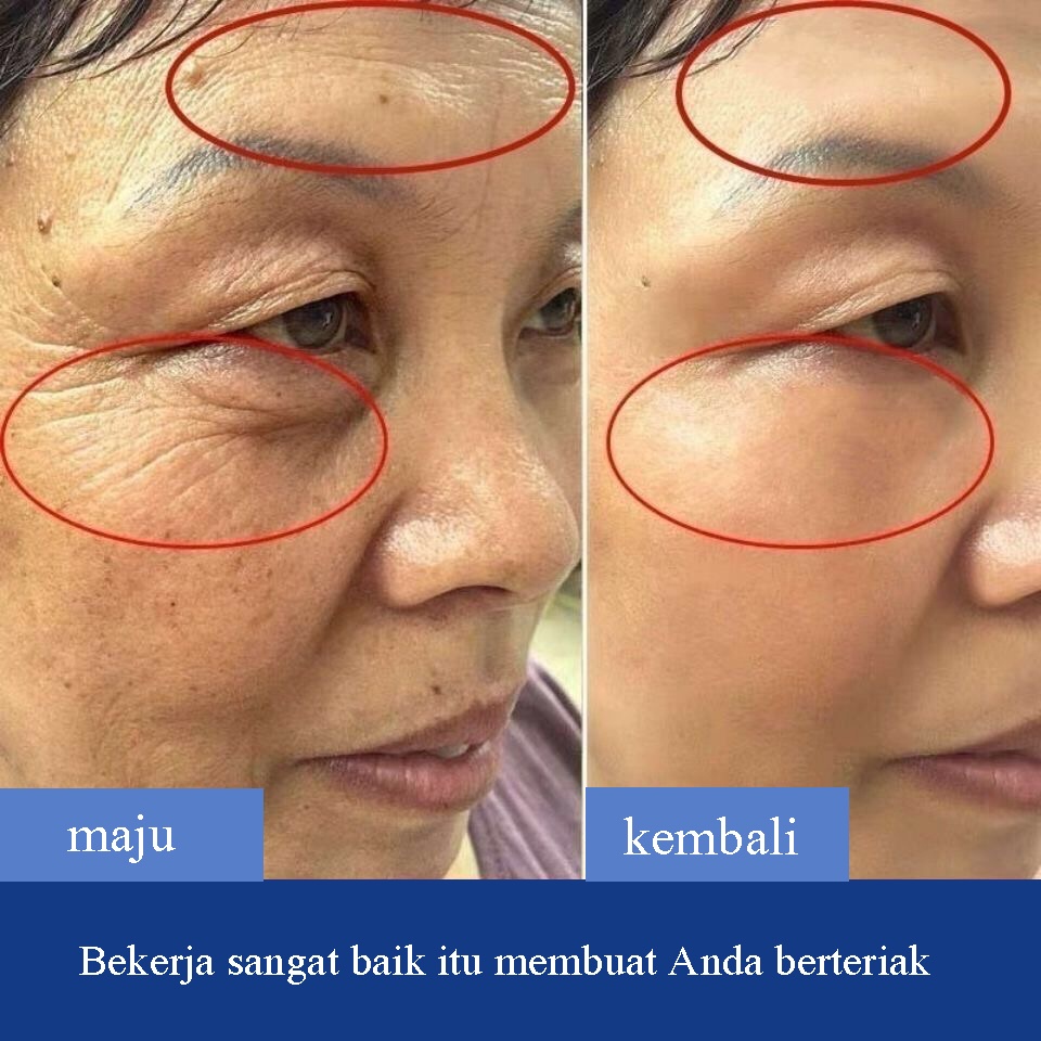 krim anti kerut 30g krim wajah pelembab krim anti penuaan krim kerut wajah - pelembut untuk penuaan dini Clear crow's feet / garis dahi / garis nasolabial / garis mulut