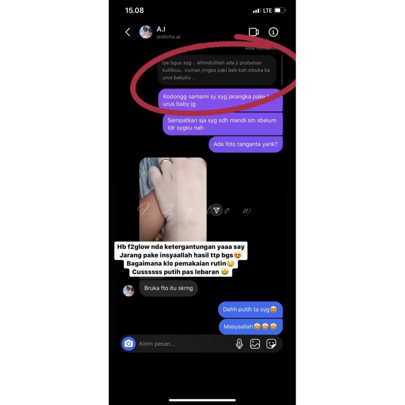 PROMO HB SUPER DOSTING AMPUH MEMUTIHKAN 7HARI  (dijamin putih)