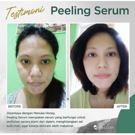 MS GLOW Peeling Serum 15ml