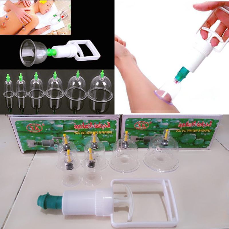 Alat Bekam | Bekam Tradisional Original