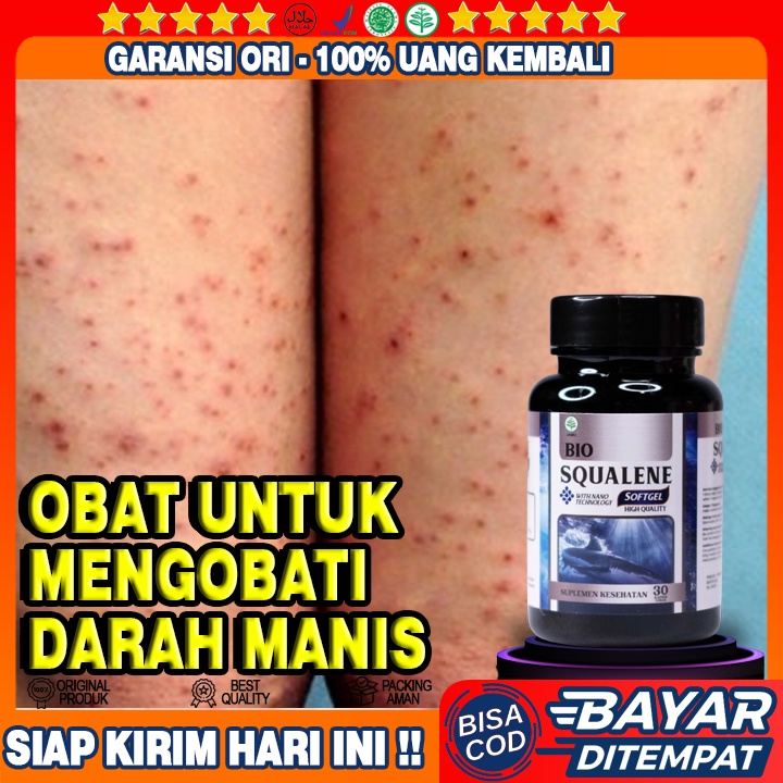 Obat Darah Manis - Gatal Prurigo - Obat Kulit Gatal-gatal - Obat Gatal Amis Daging - Obat Koreng Di 