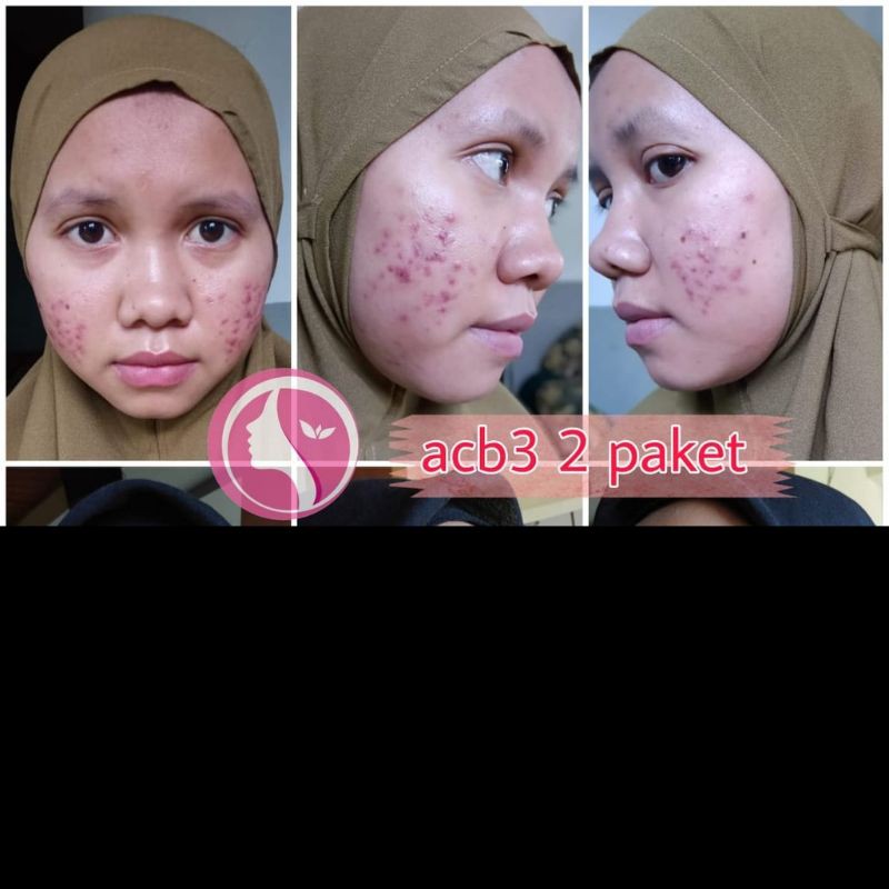 Cream DRW Skincare Paket besar Ecer