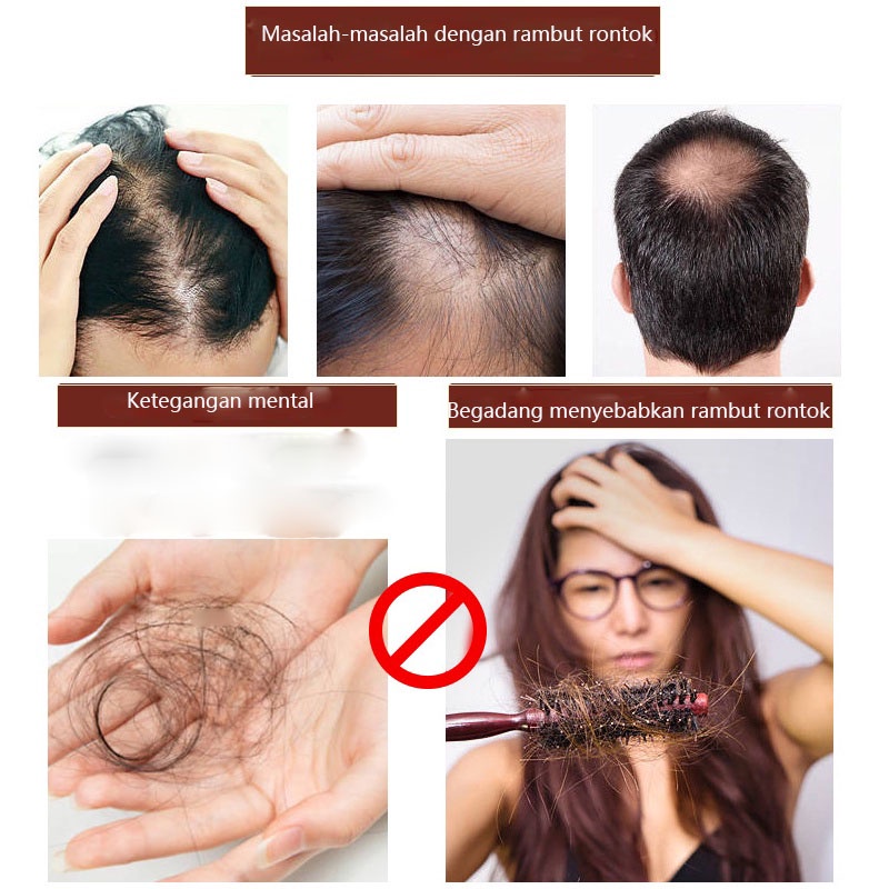 Sampo Jahe  Sampo Anti Rambut Rontok  Shampo 280g Ekstrak Jahe Alami Untuk Memperbaiki Kulit Kepala Anti Rambut Rontok