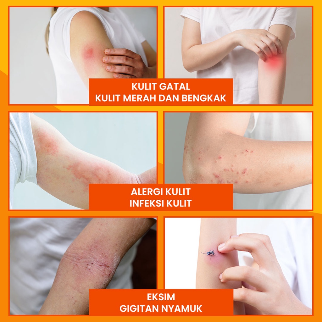 Salep Krim Binahong 20g - Salep Obat Gatal &amp; Luka Kulit Ampuh SUDAH BPOM