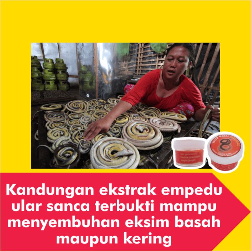 Salep Obat Gatal Eksim Kering Basah Menahun Paling Ampuh Kulit Gatel Kurap Kudis Selangkangan Jamur-6