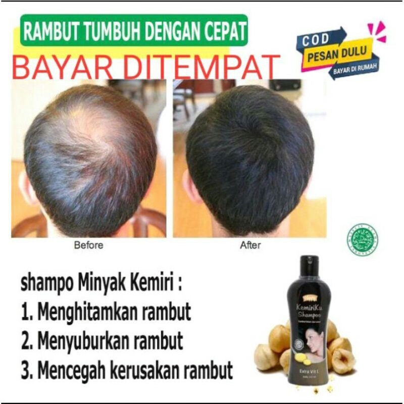 SHAMPOO KEMIRIKU PENGHITAM RAMBUT  100%ORIGINAL BPOM