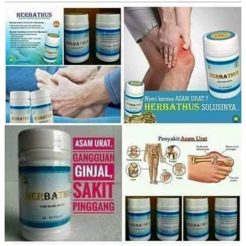 

Herbathus Obat Asam Urat