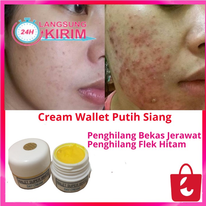 [100% Asli] Cream Walet Siang Super White Pemutih Wajah Penghilang Jerawat Penghilang Flek Hitam